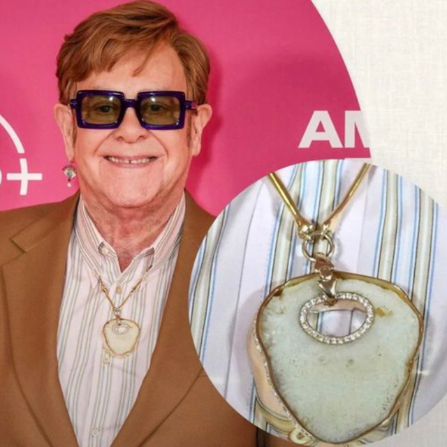 Elton John Turns His Kneecaps Into Jewellery A Story of Pain, Glamour, and Radical Self-Expression